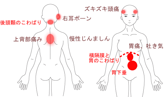 右耳ボーン 耳管異常 頭痛 胃痛 吐き気 倦怠感 不眠など 愛知県名古屋市 ｊ ｋさん 37才女性 の改善症例 胃腸と自律神経の整体 愛知名古屋のハピネス施術院