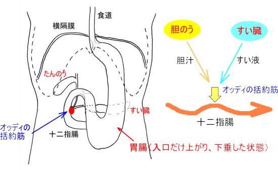 ファーター乳頭部のオッディ括約筋の不調から、胆汁とすい液の流れが悪くなる状態を説明したイラスト