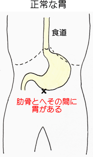 正常な胃腸の説明図